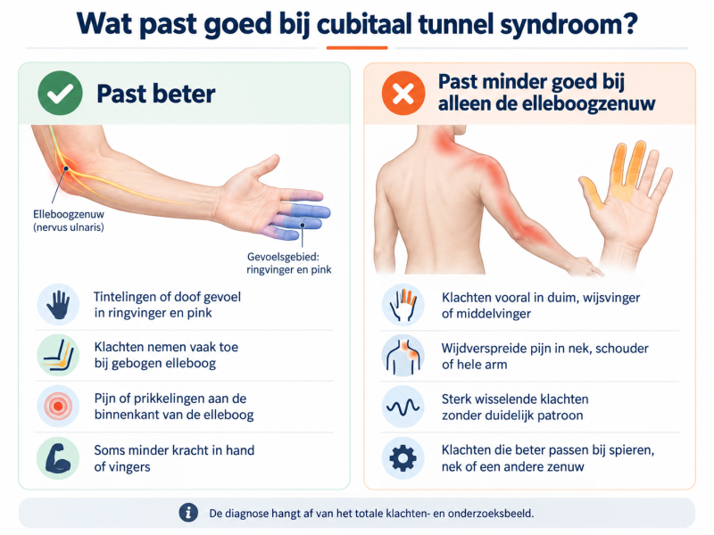 Infographic die laat zien welke klachten beter passen bij cubitaal tunnel syndroom en welke klachten minder goed passen bij alleen de elleboogzenuw.