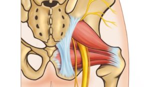 Ligging van de piriformis spier bij de grote beenzenuw.