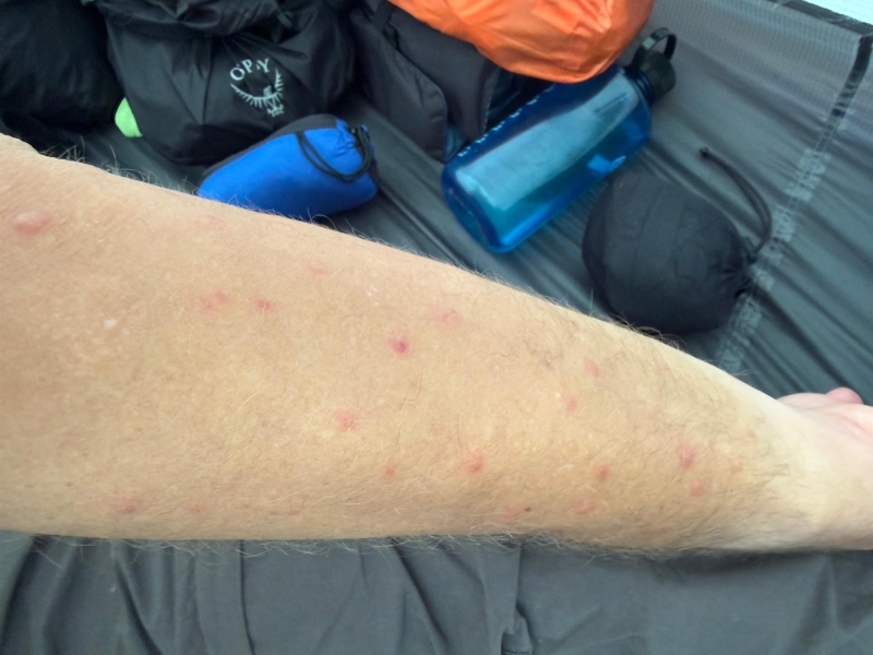 Prikken van midges in Schotland
