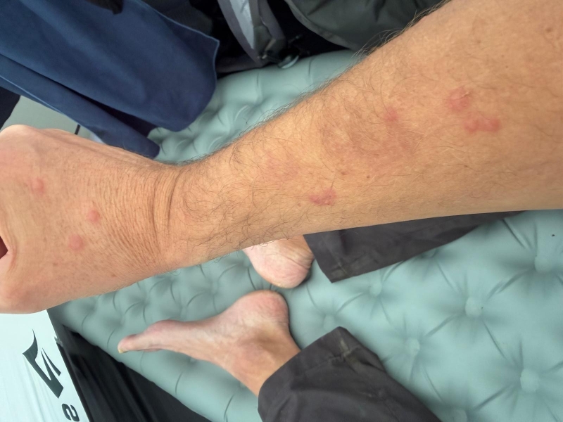 Midges of knutten in Schotland