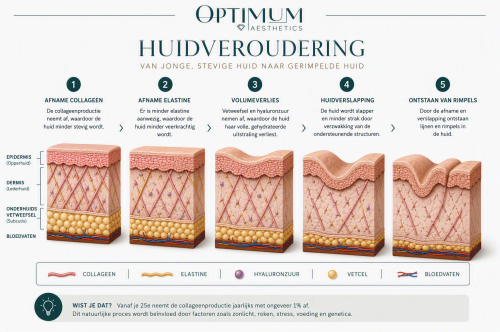 huidveroudering behandelen
