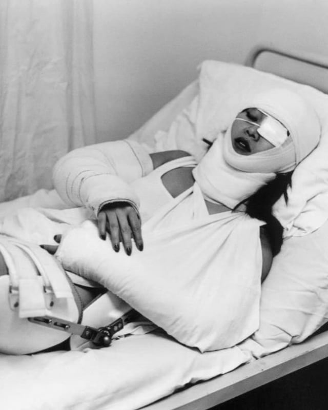 Romain Slocombe bandage