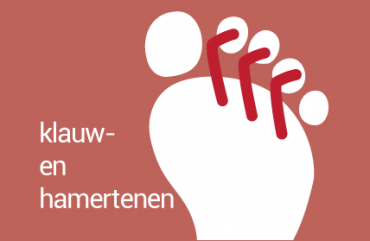 klauw- en hamertenen klauw- en hamertenen